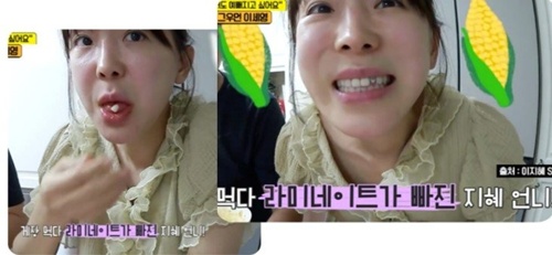 라미네이트로 시술로 이루어진 치아
