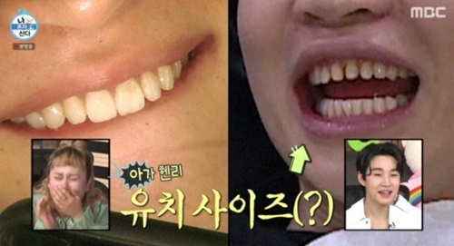 라미네이트로 시술로 이루어진 치아