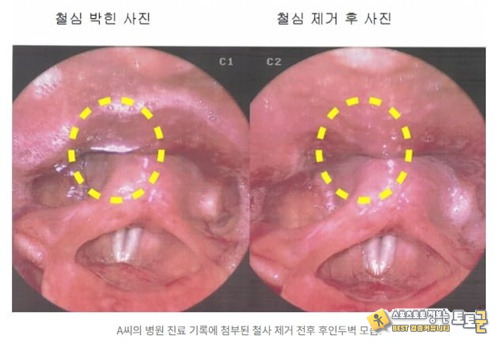 무서워서 치킨 못먹겠다