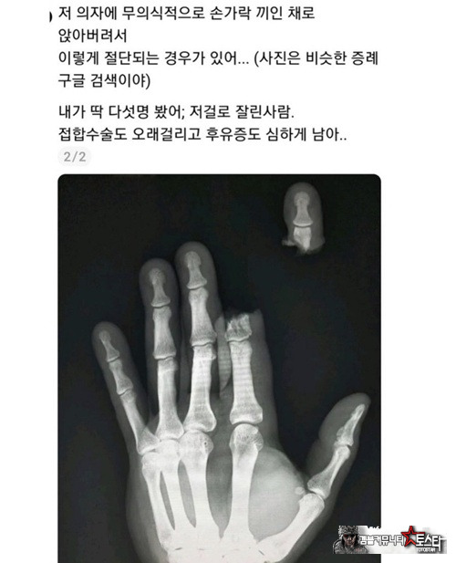 손가락 주의