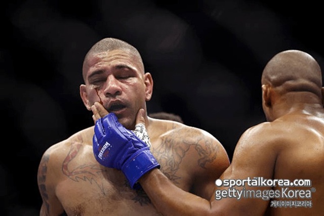 '맙소사!' 천하의 페레이라, '눈 찢어지고 출혈' TKO 패배…시릴 간 무자비한 폭격에 'UFC 3체급 챔피언 도전' 무산 '맙소사!' 천하의 페레이라, '눈 찢어지고 출혈' TKO 패배…시릴 간 무자비한 폭격에 'UFC 3체급 챔피언 도전' 무산