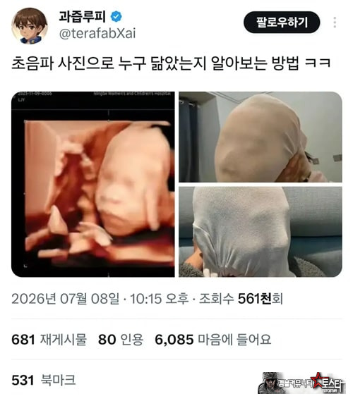 태아 초음파 사진 누구 닮았는지 알아보는 방법