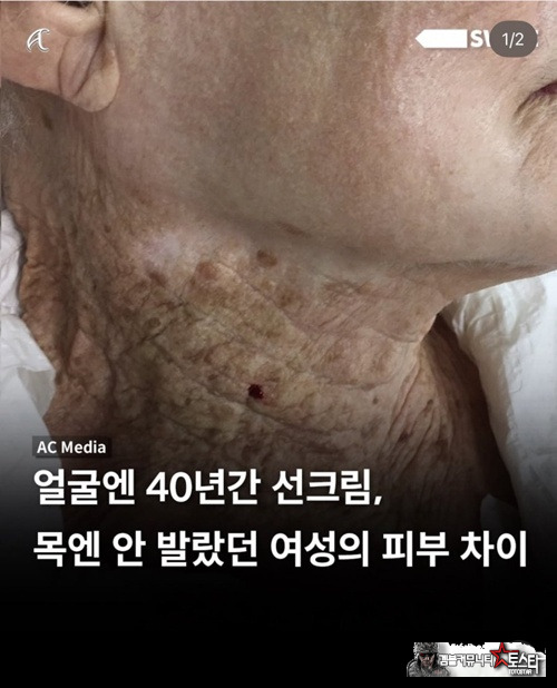 선크림의 중요성